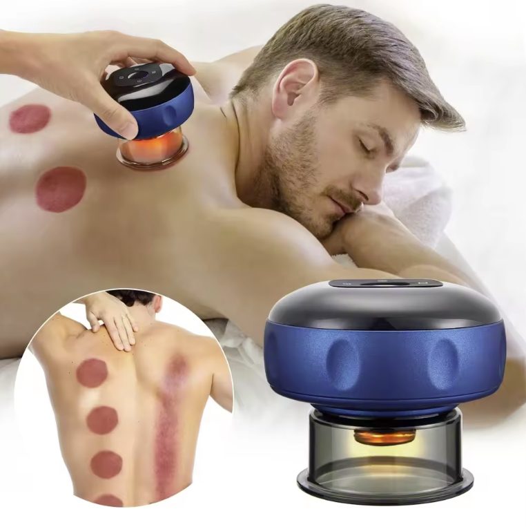 Image of an male individual laying down with NuLYFF™ Intelligent Cupper on his back, Image showcases product its red light therapy, and another image of difference between regular cupping and scrapping and its marks that are left on persons back.